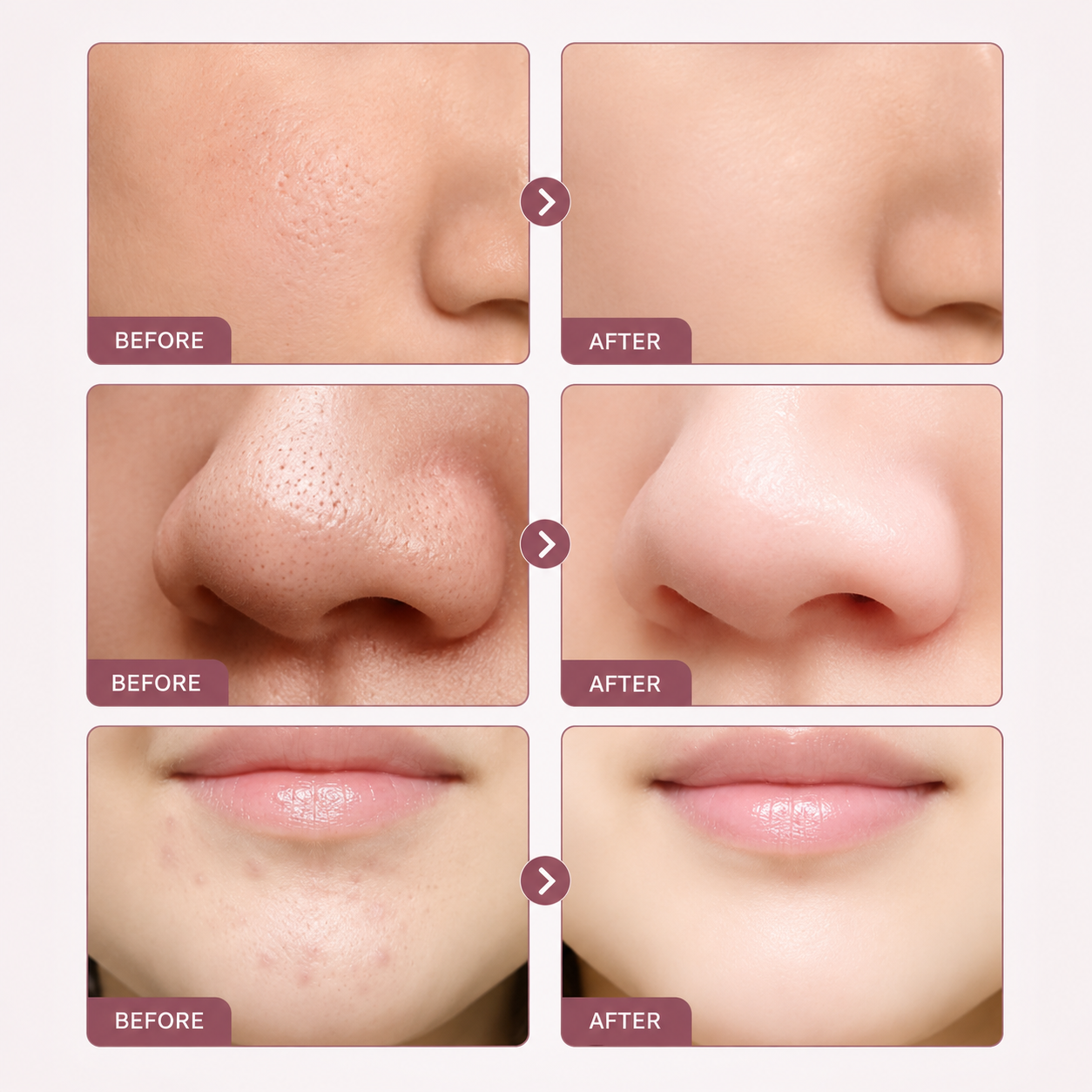 West Month Salicylic Acid Serum